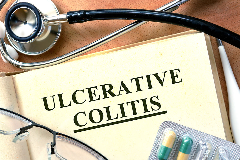 4 signs that indicate ulcerative colitis development