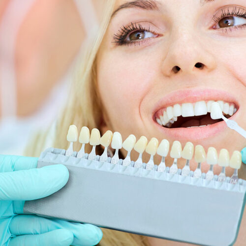 6 common dental implant mistakes and how to avoid them